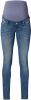 Noppies Skinny Jeans Avi Everyday Blue Every Day Blue 26/30 online kopen