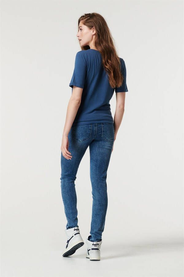 Supermom Skinny Jeans Skinny Blue Acid Blue 31